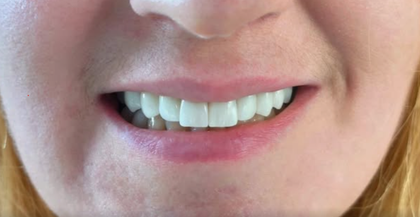 Dentistry in Athens on Facebook