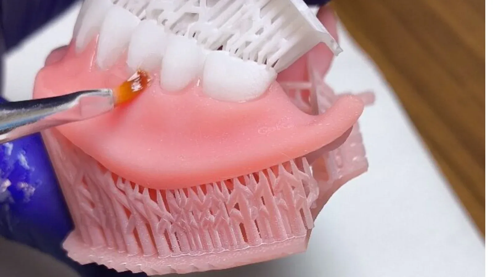 3D printed removable denture
