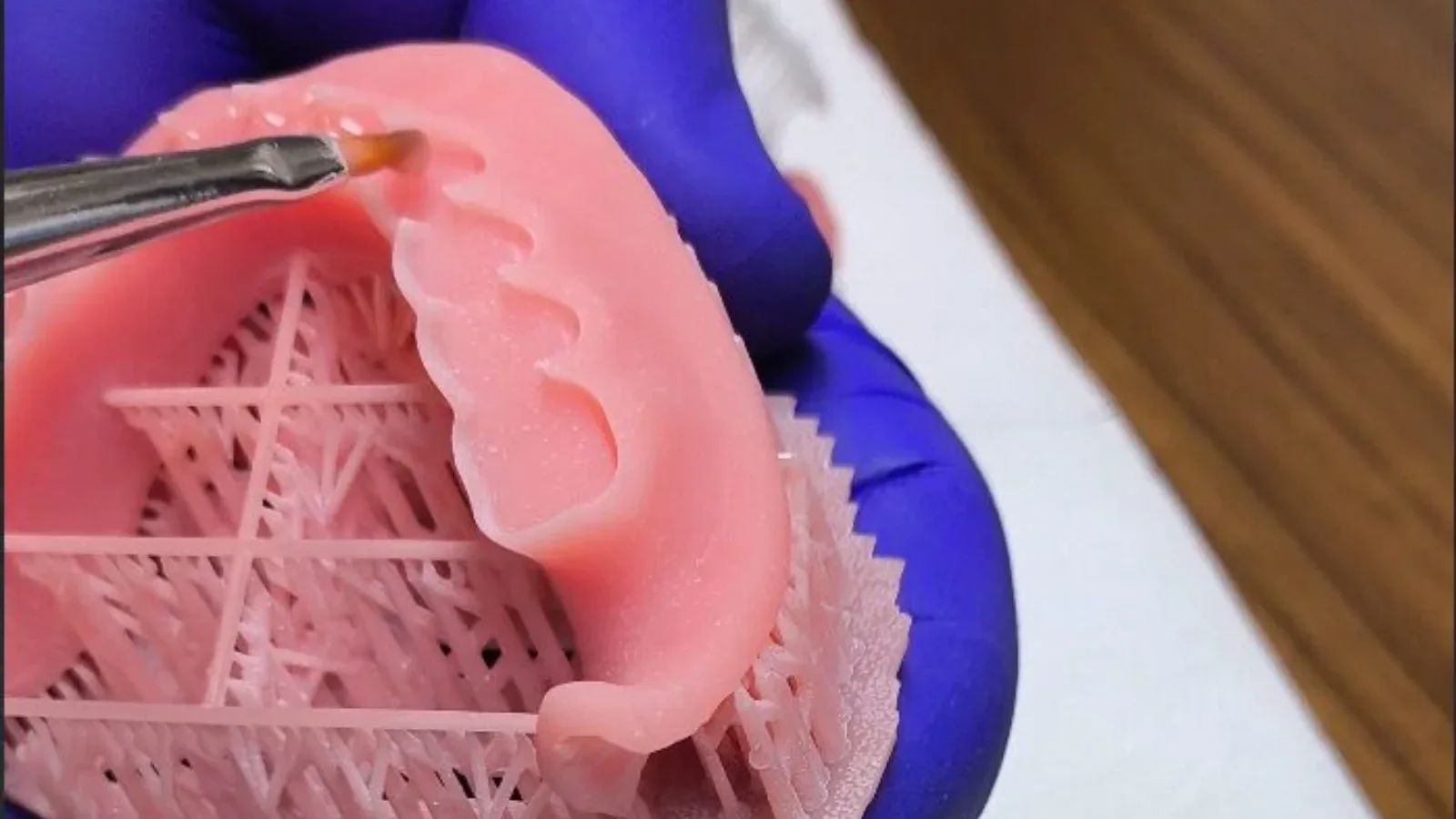 3D printed removable denture