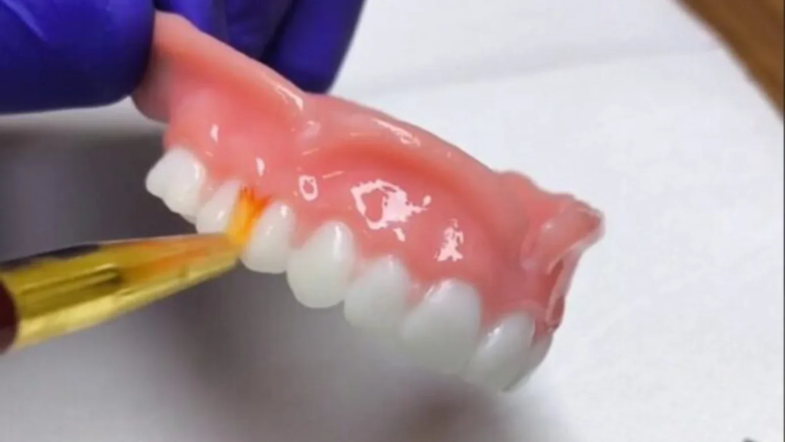 3D printed removable denture