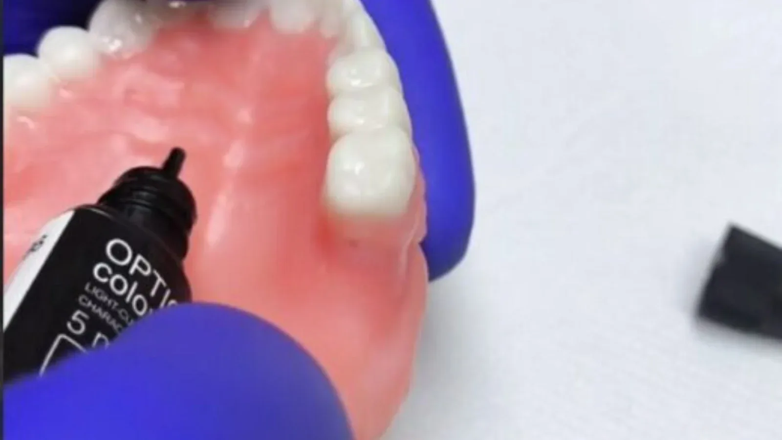 3D printed removable denture