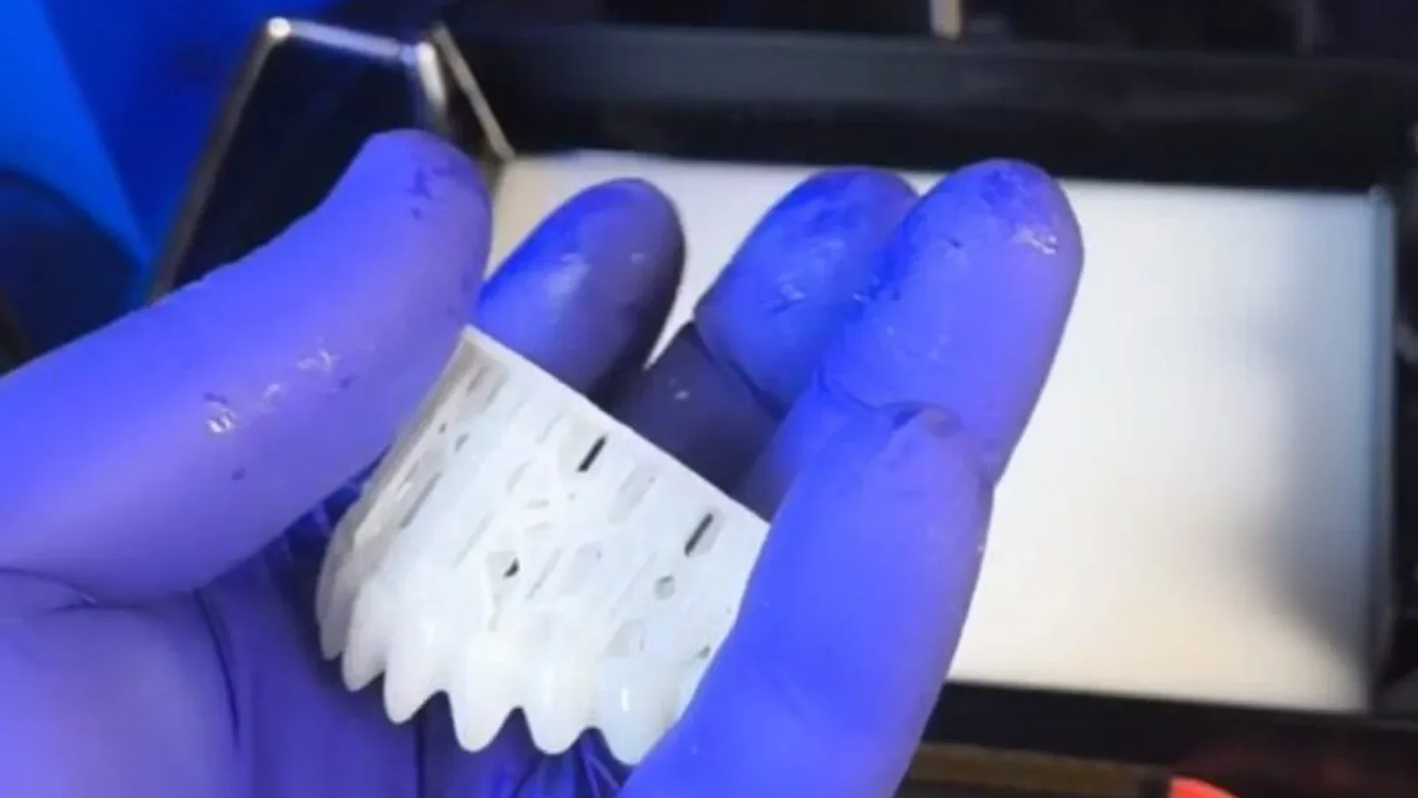 3D printed removable denture