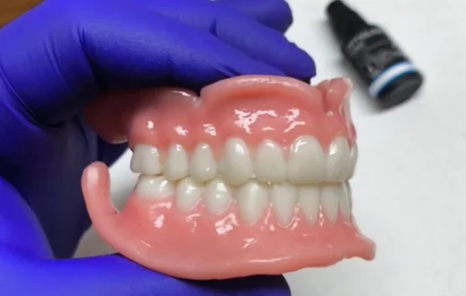 Dental case image: 3D printed removable denture
