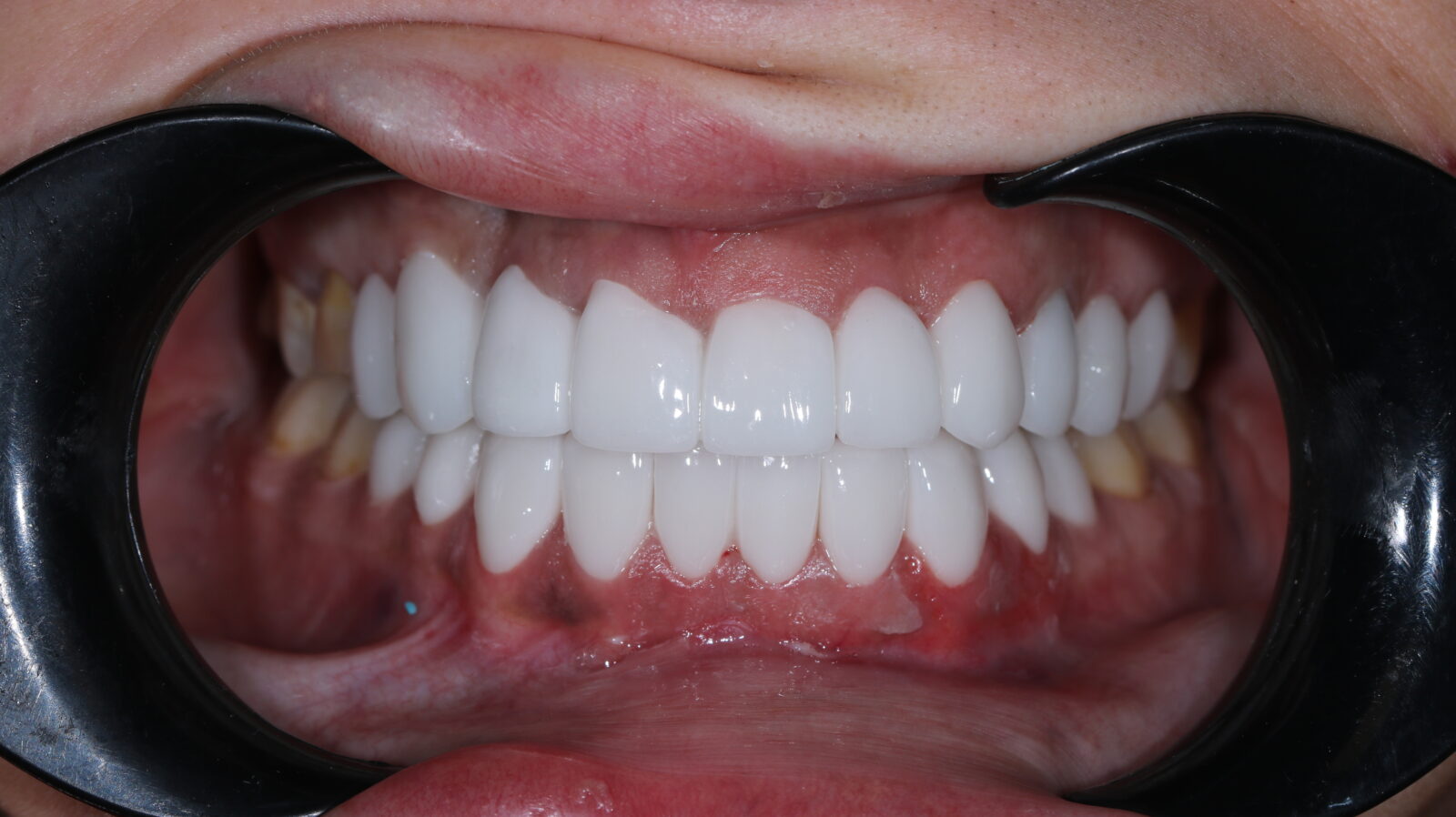 test 2