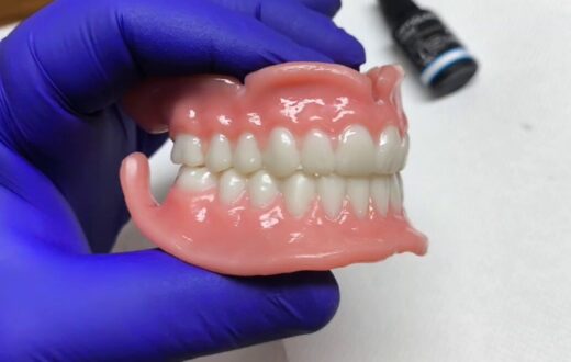 3D printed removable denture