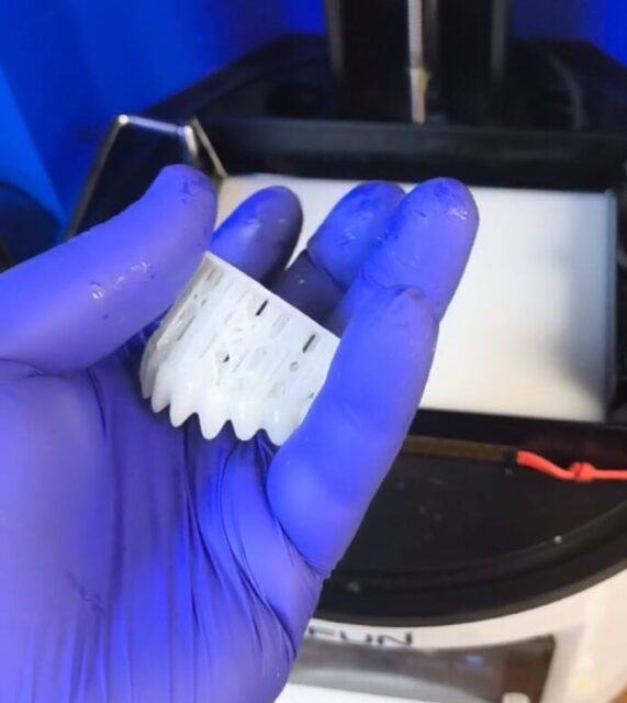 3D printed removable denture