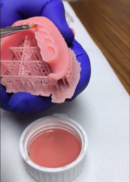 3D printed removable denture