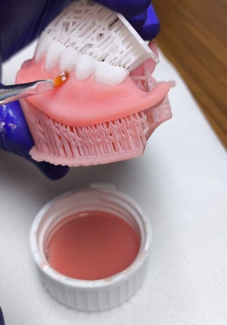 3D printed removable denture