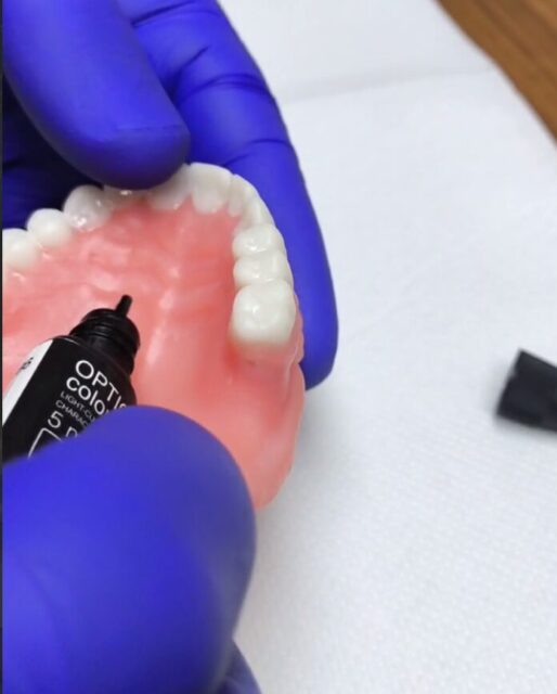 3D printed removable denture