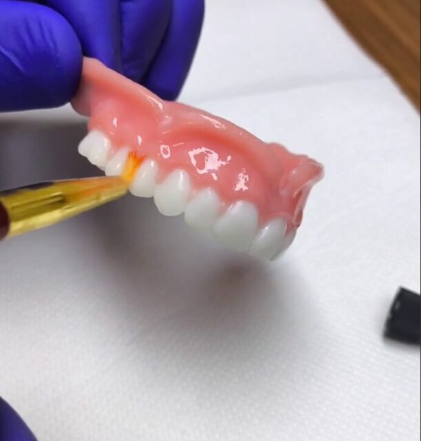 3D printed removable denture